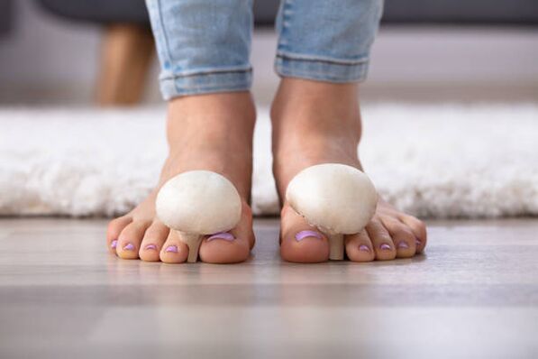 Fungus on toenails