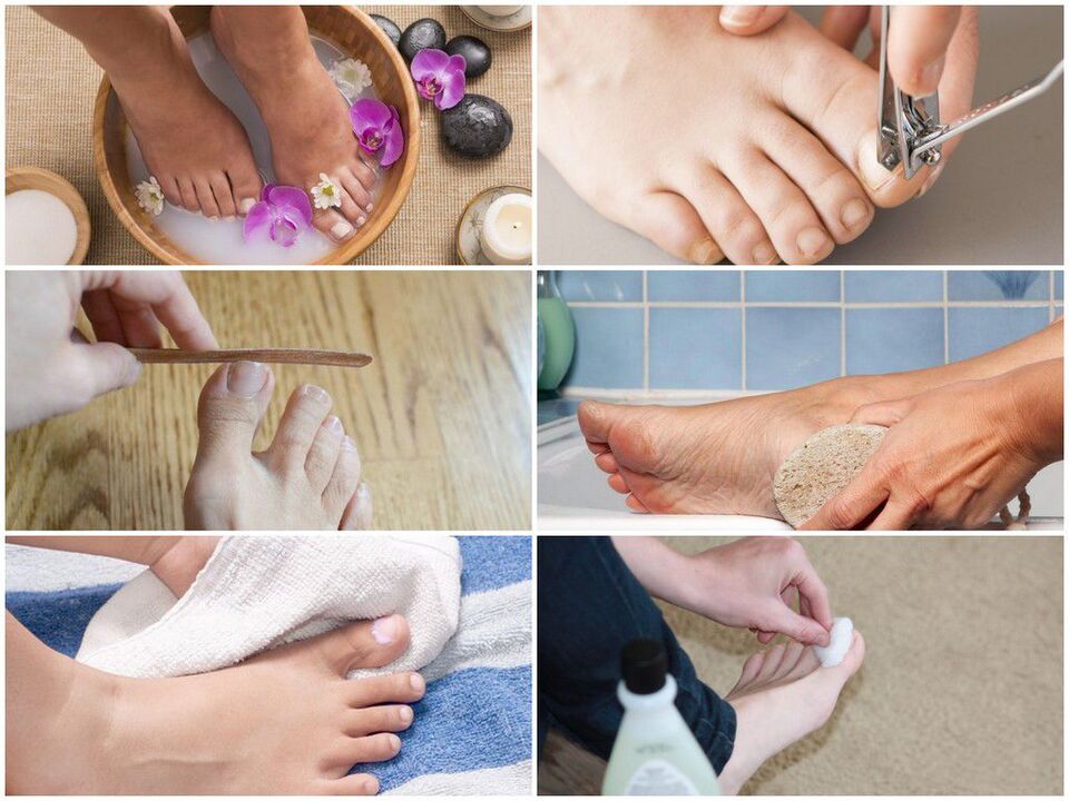 Prevention of nail fungus