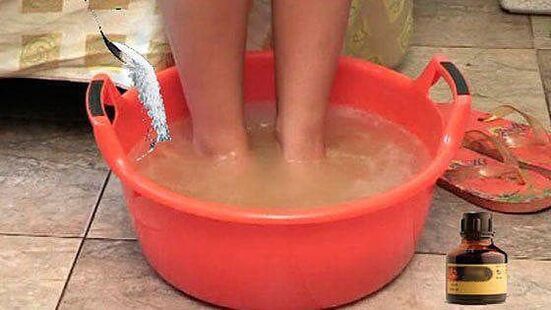 A hot bath with iodine is one of the steps to treat toenail fungus