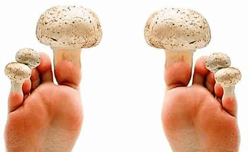 Mushroom on the nails