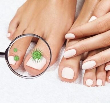 Nail infection by a magnifying glass