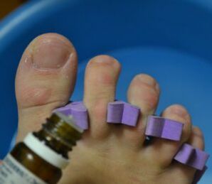 Preparation for treating nails with anti-fungal drops