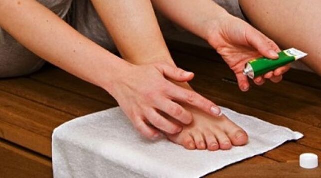 Treating toenail fungus with ointment