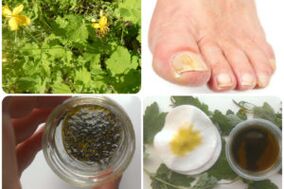 Folk remedies for toenail fungus